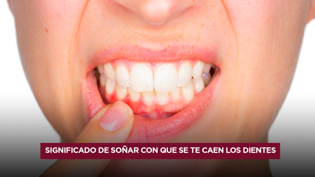 Significado de soñar con que se te caen los dientes